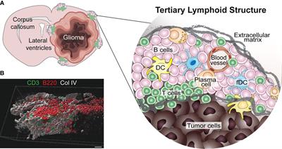 Tertiary Lymphoid Structures in the Central Nervous System: Implications for Glioblastoma